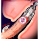 Насадка для збільшення пеніса Crystal Skin Penishulle Vibro з вібрацією